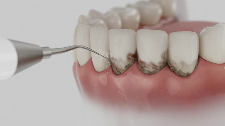 Trusted Teeth Cleaning And Checkup service in Elizabethville, PA - Dentist Open Now